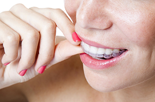 Invisalign in Joliet, IL 60431